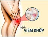 Bệnh thấp khớp là gì